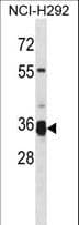 TMPRSS12 Antibody (aa26-54)