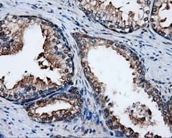 PSMC3 Antibody (clone OTI8D6)