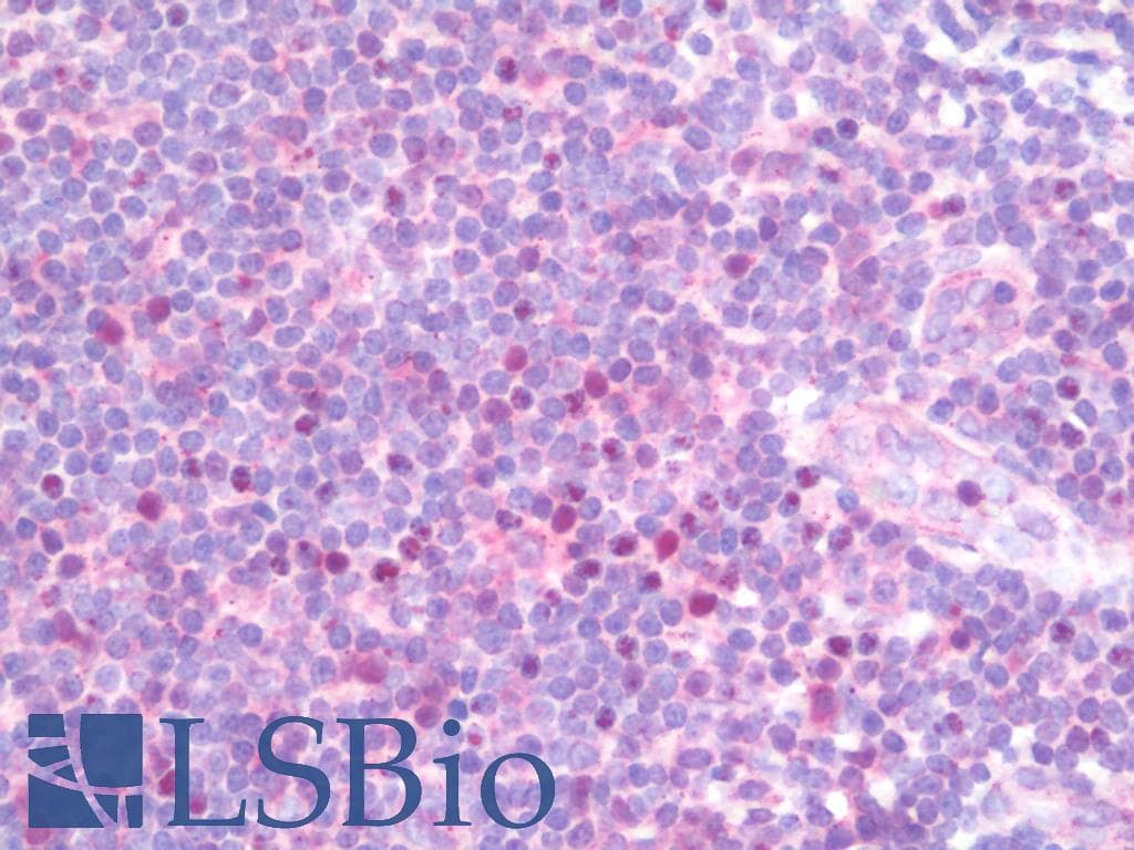 IHC-plus™ TBX21 / T-bet Antibody