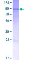 Human LACE1 Protein (Recombinant GST)