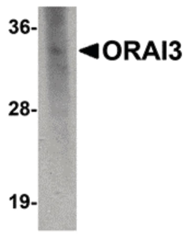 IHC-plus™ ORAI3 Antibody (clone 2H2G9)