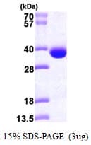 Human SRM / Spermidine Synthase Protein (Recombinant His)