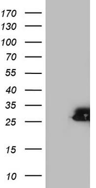 SPA17 / Sperm Protein 17 Antibody (clone OTI4A2)
