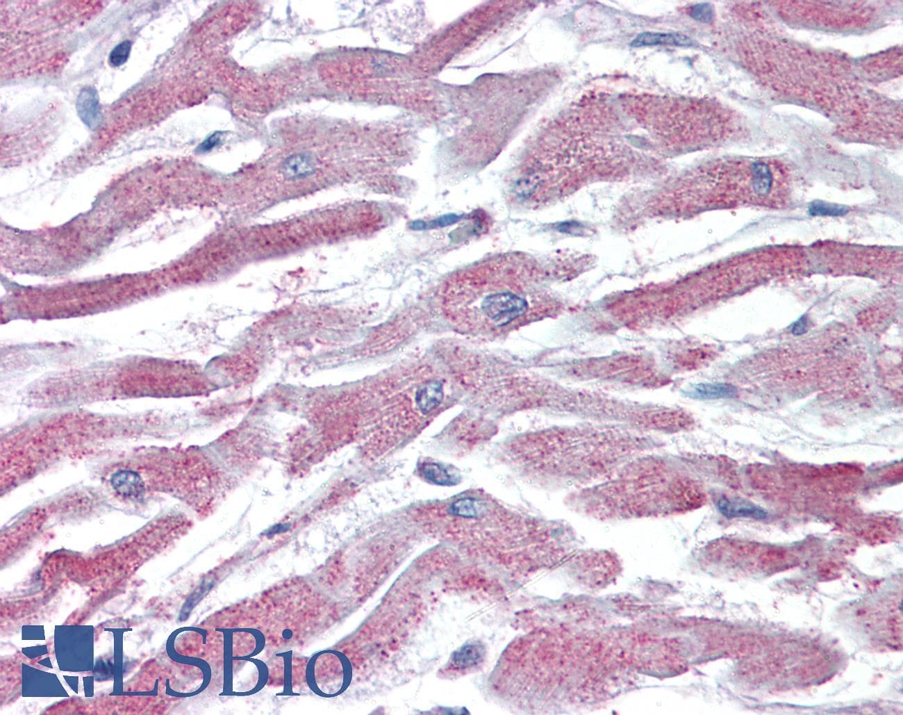 IHC-plus™ AKT3 Antibody (aa119-133)