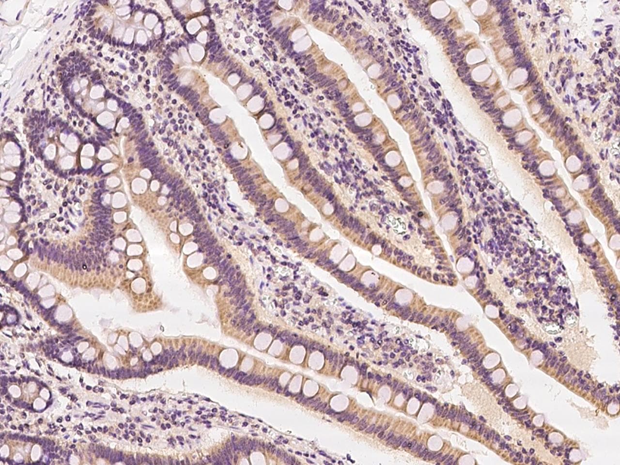 VPS35 Antibody