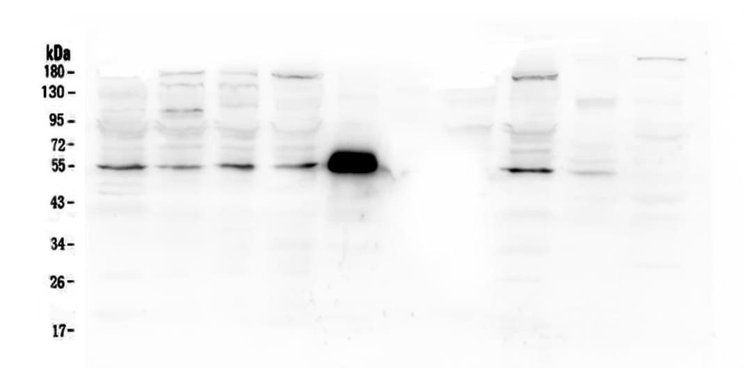 MMP13 Antibody