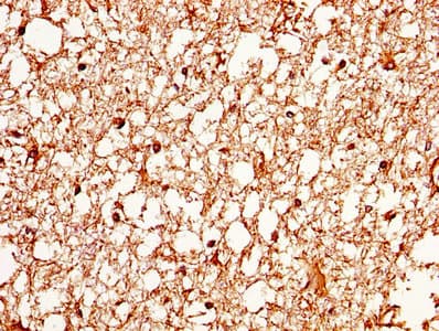 AQP4 / Aquaporin 4 Antibody (aa253-323)