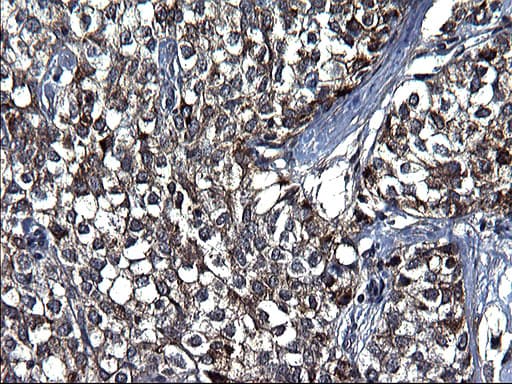 FGG / Fibrinogen Gamma Antibody (clone OTI1D1, Carrier-free)