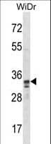 IHC-plus™ SPI1 / PU.1 Antibody (aa217-246)
