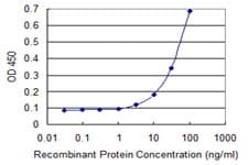SCNN1G / ENaC Gamma Antibody (clone 2F3)