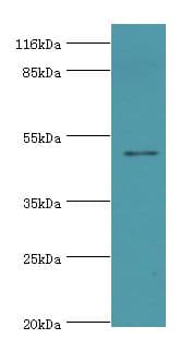 Polyclonal Rabbit anti-Human CCDC14 Antibody (FITC, IHC, WB)