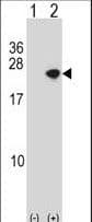 SNCA / Alpha-Synuclein Antibody (aa104-133)