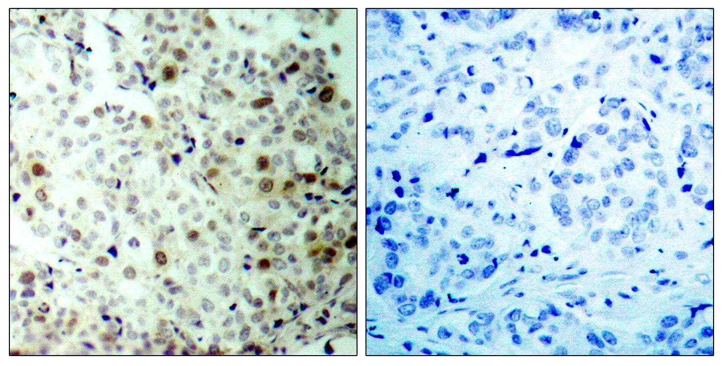 CDK2 Antibody (phospho-Thr160)