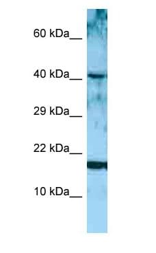 Polyclonal Rabbit anti-Human ARTN / Artemin Antibody (aa77-126, WB)