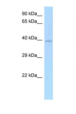 Polyclonal Rabbit anti-Human CD33 Antibody (aa45-94, WB)