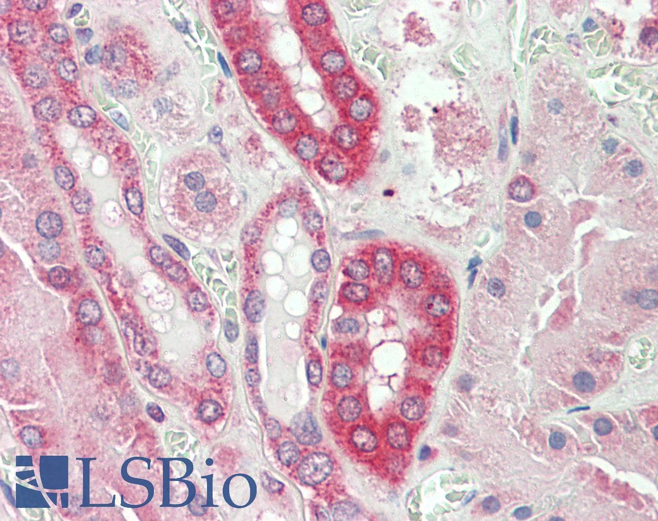 IHC-plus™ Polyclonal Goat anti-Human CAPN1 / Calpain 1 Antibody (aa515-526, IHC, WB)