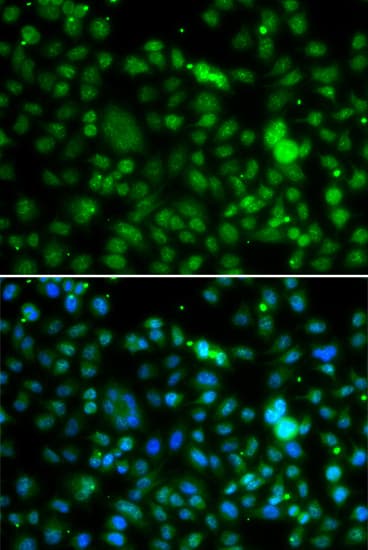 NSUN6 Antibody