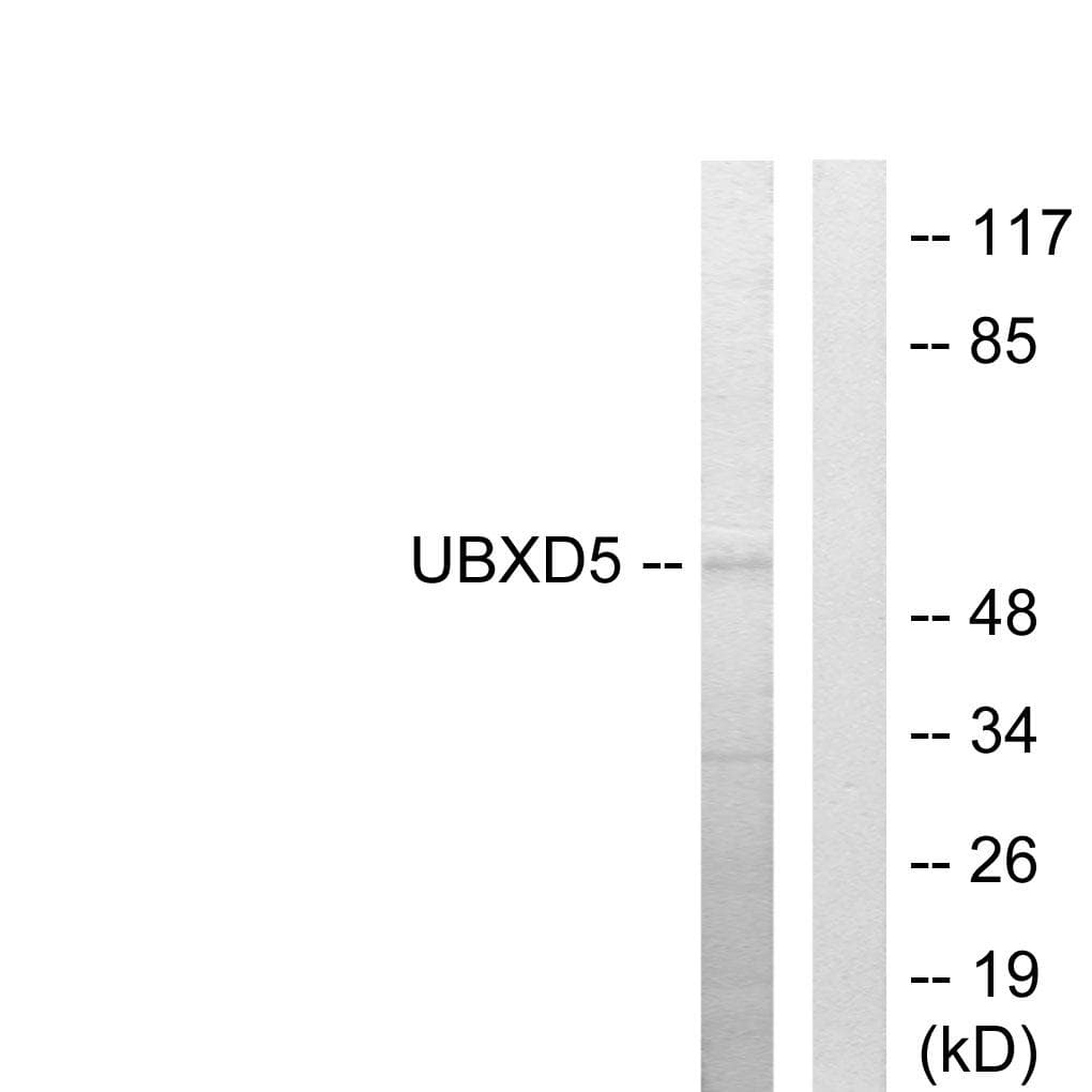 RB1 / Retinoblastoma / RB Antibody