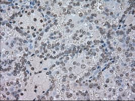 CTAG1B / NY-ESO-1 Antibody (clone OTI2B6)