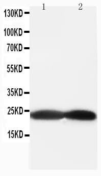 Polyclonal Rabbit anti-Human BAK1 / BAK Antibody (aa74-95, IHC, WB)