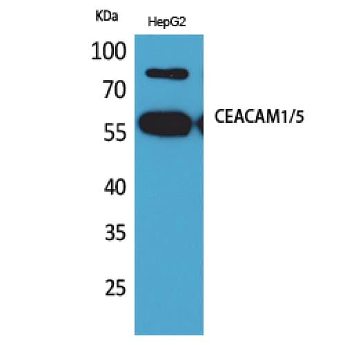 CEACAM1,5 Antibody (31-80 aa, N-terminal)