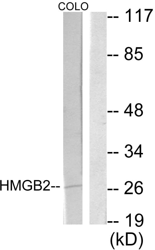 HMG2 / HMGB2 Antibody (aa131-180)