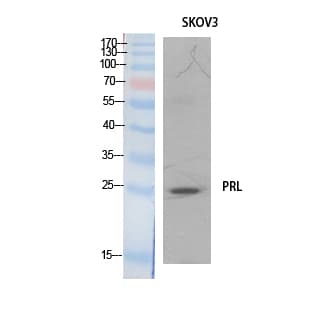 PRL / Prolactin Antibody