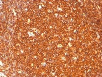 HLA-DRB1 Antibody (clone SPM289)