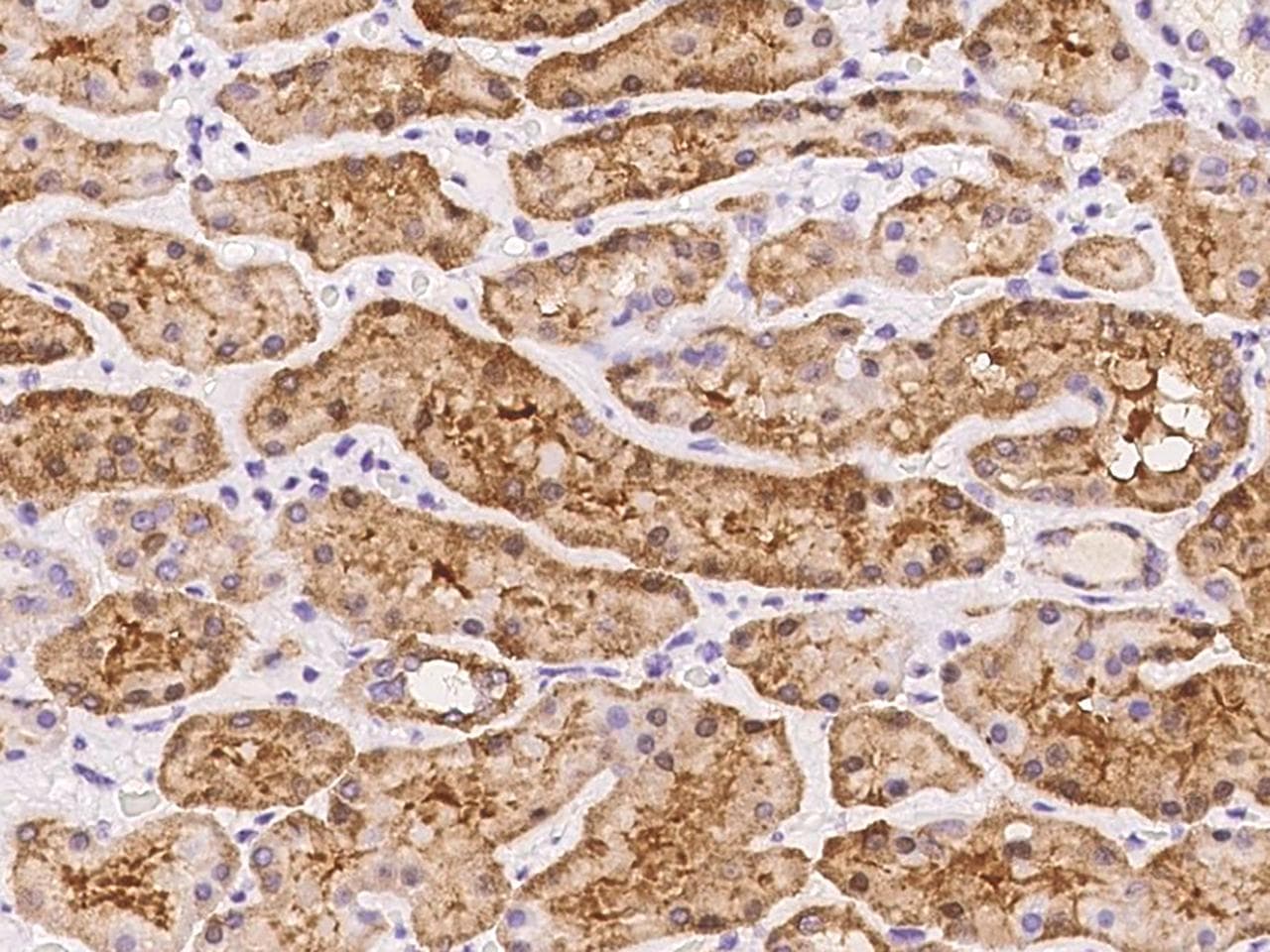 TMEM65 Antibody