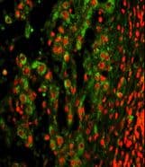 Polyclonal Rabbit anti-Human ITGAX / CD11c Antibody (aa1119-1145, IHC, IF, WB)