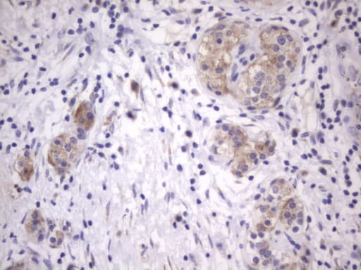 ITGB1BP1 / ICAP1 Antibody (clone OTI6A12, Carrier-free)