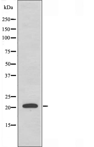 Polyclonal Rabbit anti-Human MRPL35 Antibody (IF, WB)