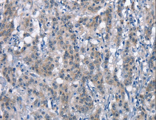 Polyclonal Rabbit anti-Human DNAM-1 / CD226 Antibody (IHC)