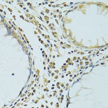 METTL13 / KIAA0859 Antibody