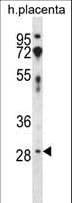 Polyclonal Rabbit anti-Human CD200 Antibody (aa183-211, WB)
