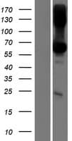 TMEM151B Protein (Over-Expression Lysate Myc-DDK (Flag))