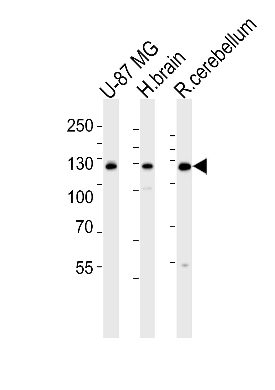 Polyclonal Rabbit anti-Mouse CAMKK2 Antibody (aa43-71, WB)