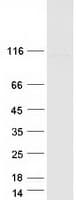 Human FIG4 Protein (Recombinant Myc-DDK (Flag))