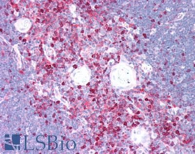 IHC-plus™ TPP1 / CLN2 Antibody (aa66-324)