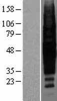 Rhodopsin / RHO Protein (Over-Expression Lysate Myc-DDK (Flag))