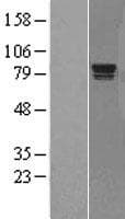 RAD17 Protein (Over-Expression Lysate Myc-DDK (Flag))