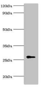 Polyclonal Rabbit anti-Human NAA10 / ARD1A Antibody (aa161-235, IHC, WB)