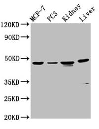 HPN / TMPRSS1 / Hepsin Antibody