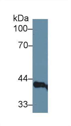 PSIP1 / LEDGF Antibody (aa311-469, APC)