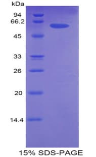 Mouse CDK2 Protein (Recombinant His-MBP)