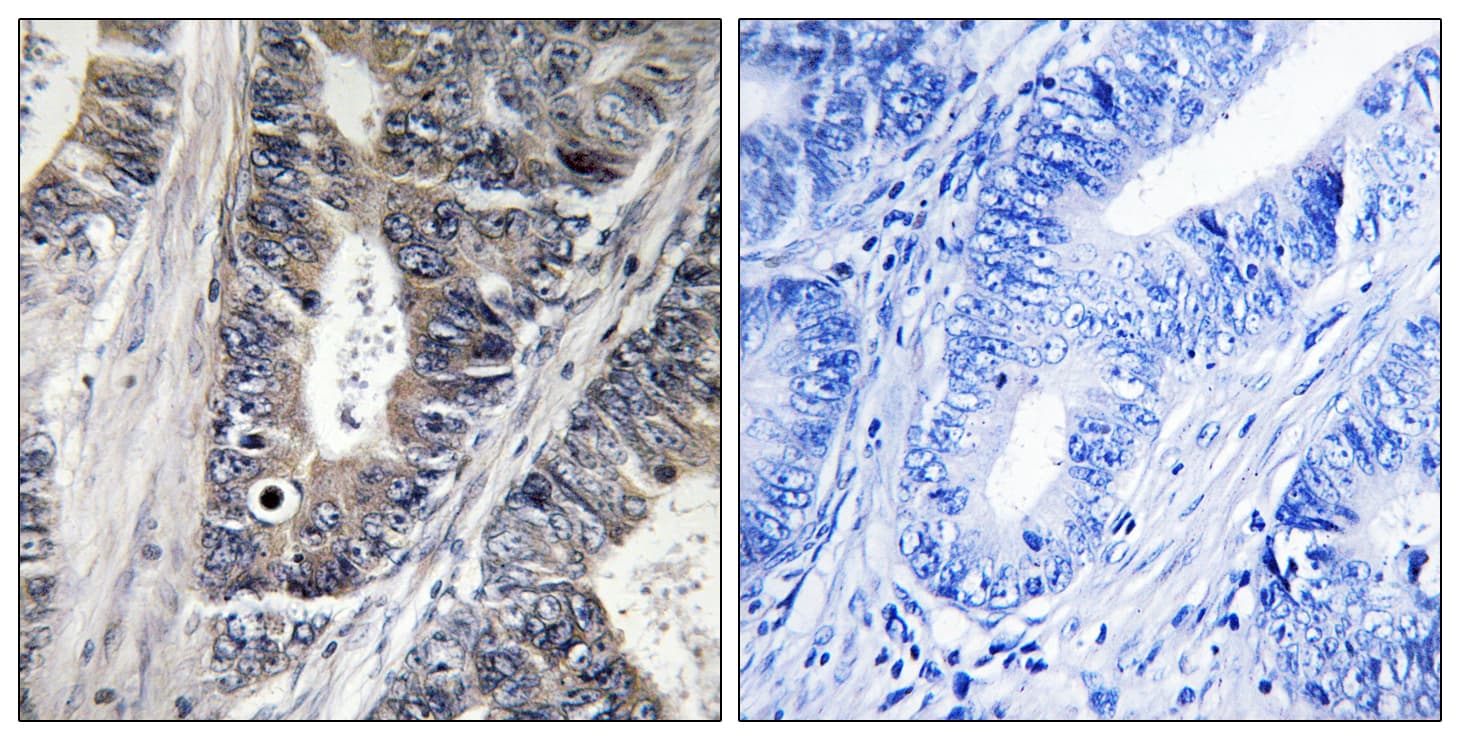 Polyclonal Rabbit anti-Human MAP3K9 / MLK1 Antibody (aa561-610, IHC)