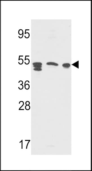 Polyclonal Rabbit anti-Human PSAP / Prosaposin Antibody (aa285-314, WB)