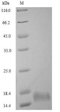 Human Oxytocin Protein (Recombinant)