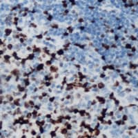 BCL6 Antibody (Internal)
