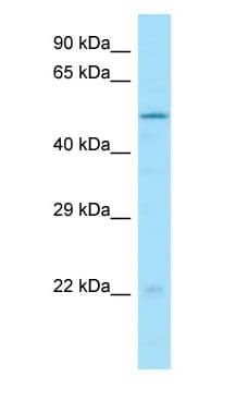DTNA / Dystrobrevin Alpha Antibody (C-Terminus)